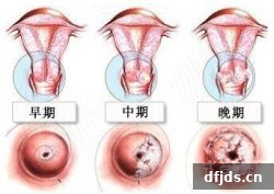 dfjds.cn 版权所有 东方监督所 dfjds.cn - 试管婴儿