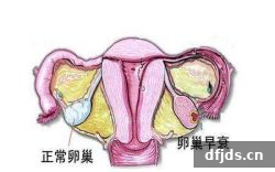 东方监督所 dfjds.cn - 试管婴儿