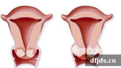 东方监督所 dfjds.cn - 试管婴儿
