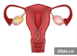 东方监督所 dfjds.cn - 试管婴儿