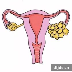 dfjds.cn 版权所有 东方监督所 dfjds.cn - 试管婴儿